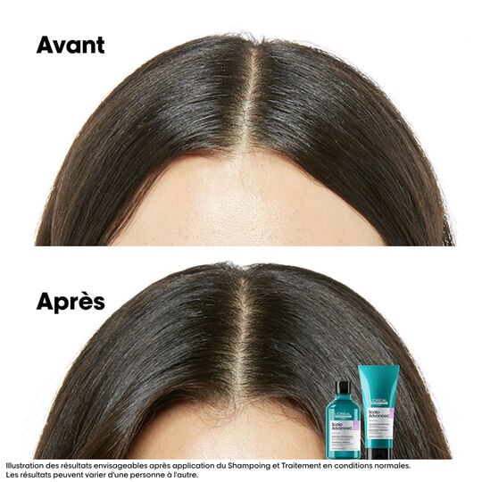 Intensive beruhigende Behandlung Scalp Advanced