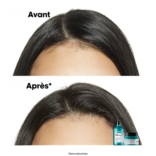 Dermo-reinigendes Anti-Fett-Shampoo Scalp Advanced